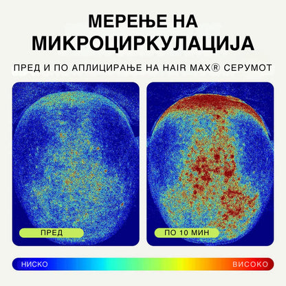 Hair Мax® - активирачки серум за раст на коса